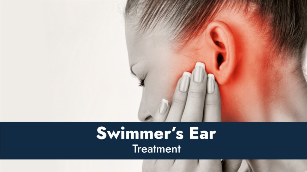 How to treat Swimmer’s Ear condition?